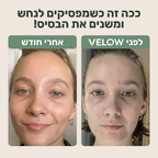 VELOW-מגבות פנים חד פעמיות לשמירה על עור נקי ובריא
