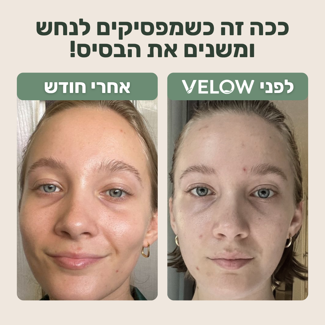VELOW-מגבות פנים חד פעמיות לשמירה על עור נקי ובריא