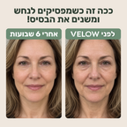 VELOW-מגבות פנים חד פעמיות לשמירה על עור נקי ובריא